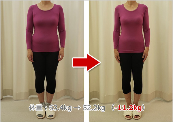 Lekumobeforeafter3_2