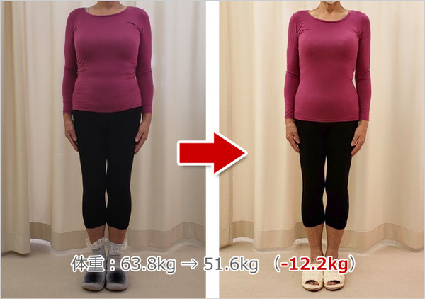Lekumobeforeafter3_3
